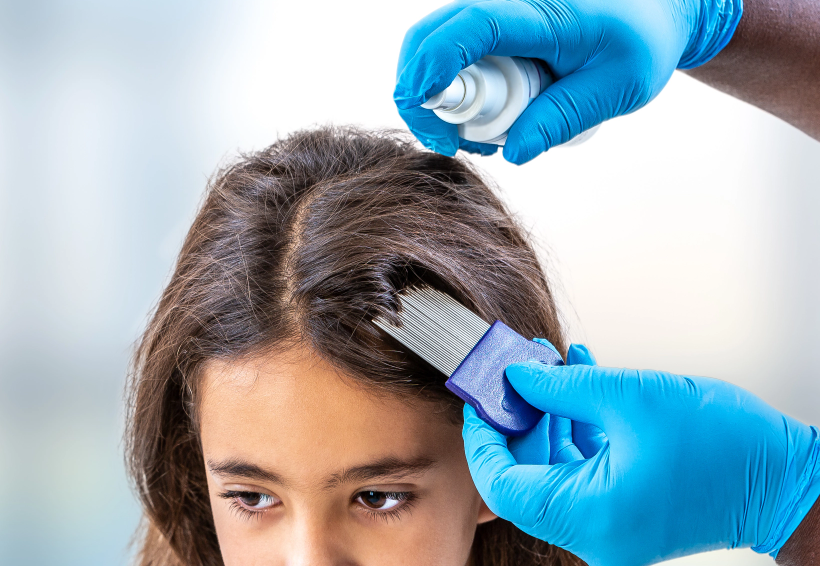 How to Prevent and treat lice in kids with ZAP